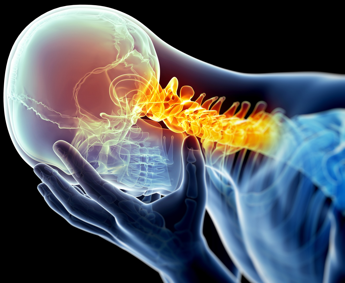migraine-image