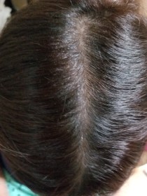hair7