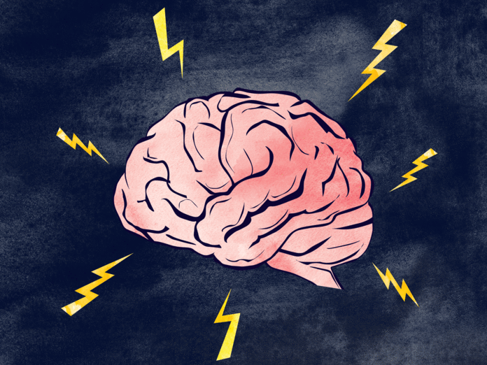 033018-migraine-brain-lead